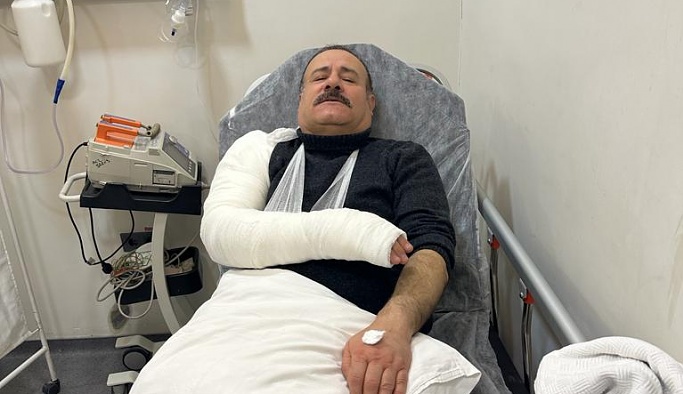 Nevşehir Fırıncılar Odası Başkanı Caner Erdoğan kolunu kırdı
